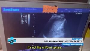 A Liver Encountered Case pt1