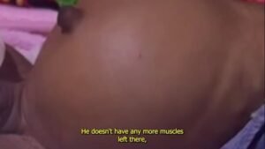 A RARE ENCOUNTERED CASE