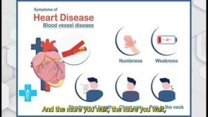 The Classic or Obvious Signs of Heart Attack