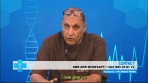 A rare encountered case of a bisexual baby pt2