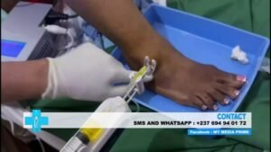 Practical application of PRP therapy