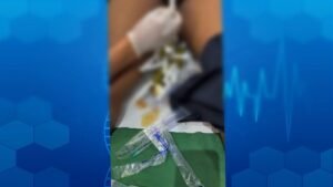 An encountered case of a man with fluids in the testis